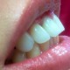 Zahnimplantate und Zahnersatz aus einer Hand in unserer Praxis in Leipzig 7