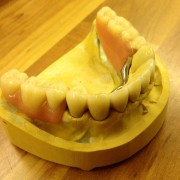 Zahnimplantate und Zahnersatz aus einer Hand in unserer Praxis in Leipzig 3
