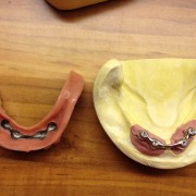 Zahnimplantate und Zahnersatz aus einer Hand in unserer Praxis in Leipzig 9