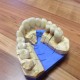 Zahnimplantate und Zahnersatz aus einer Hand in unserer Praxis in Leipzig 2